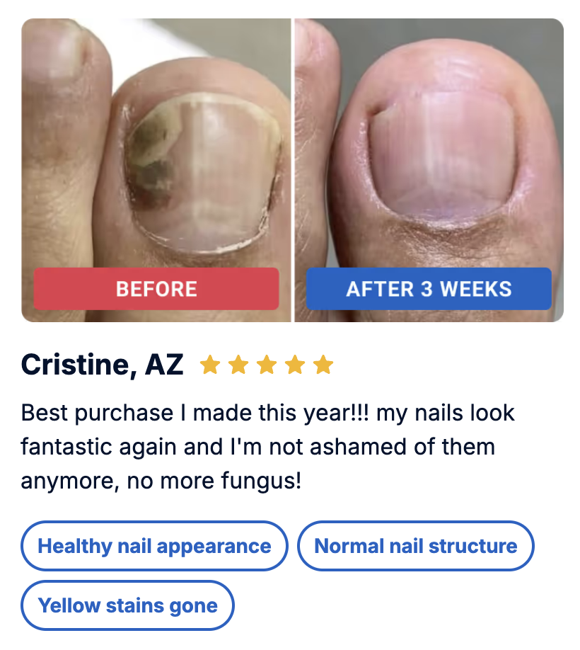David's nail fungus transformation